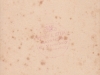 molnar__1